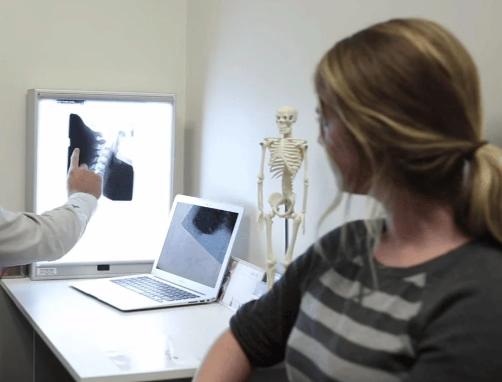 A woman in striped shirt sitting in a medical consultation room, looking at an X-ray of a shoulder held by a medical professional. A skeleton model and a laptop are on the table.