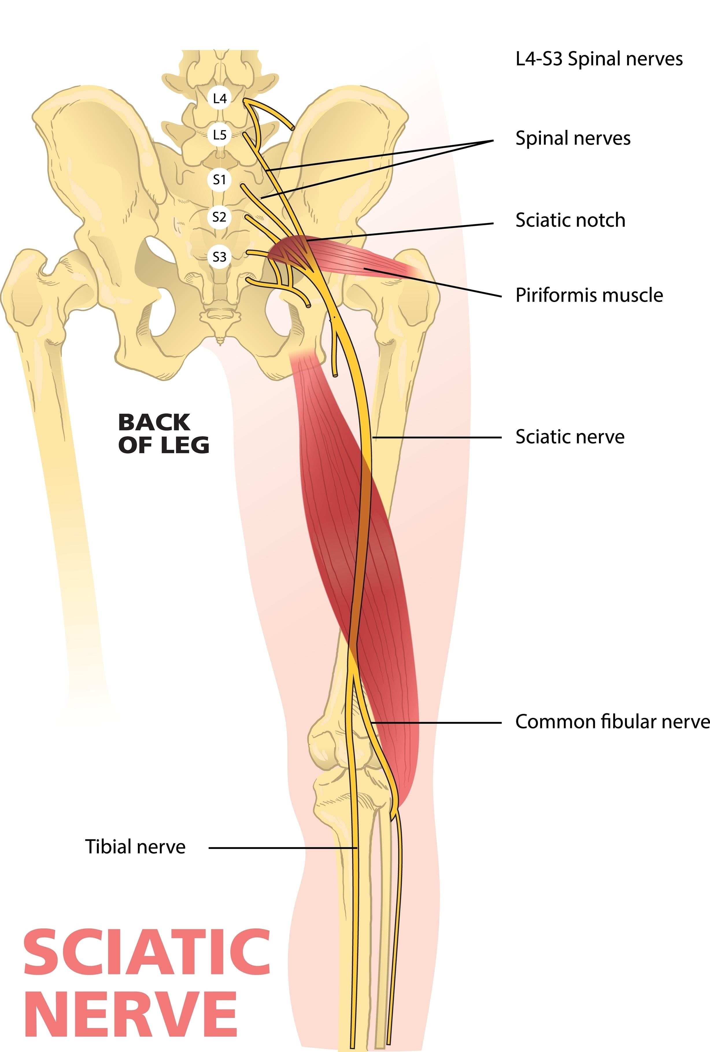 Sciatica &amp; Disc Herniation (The Combined Approach)