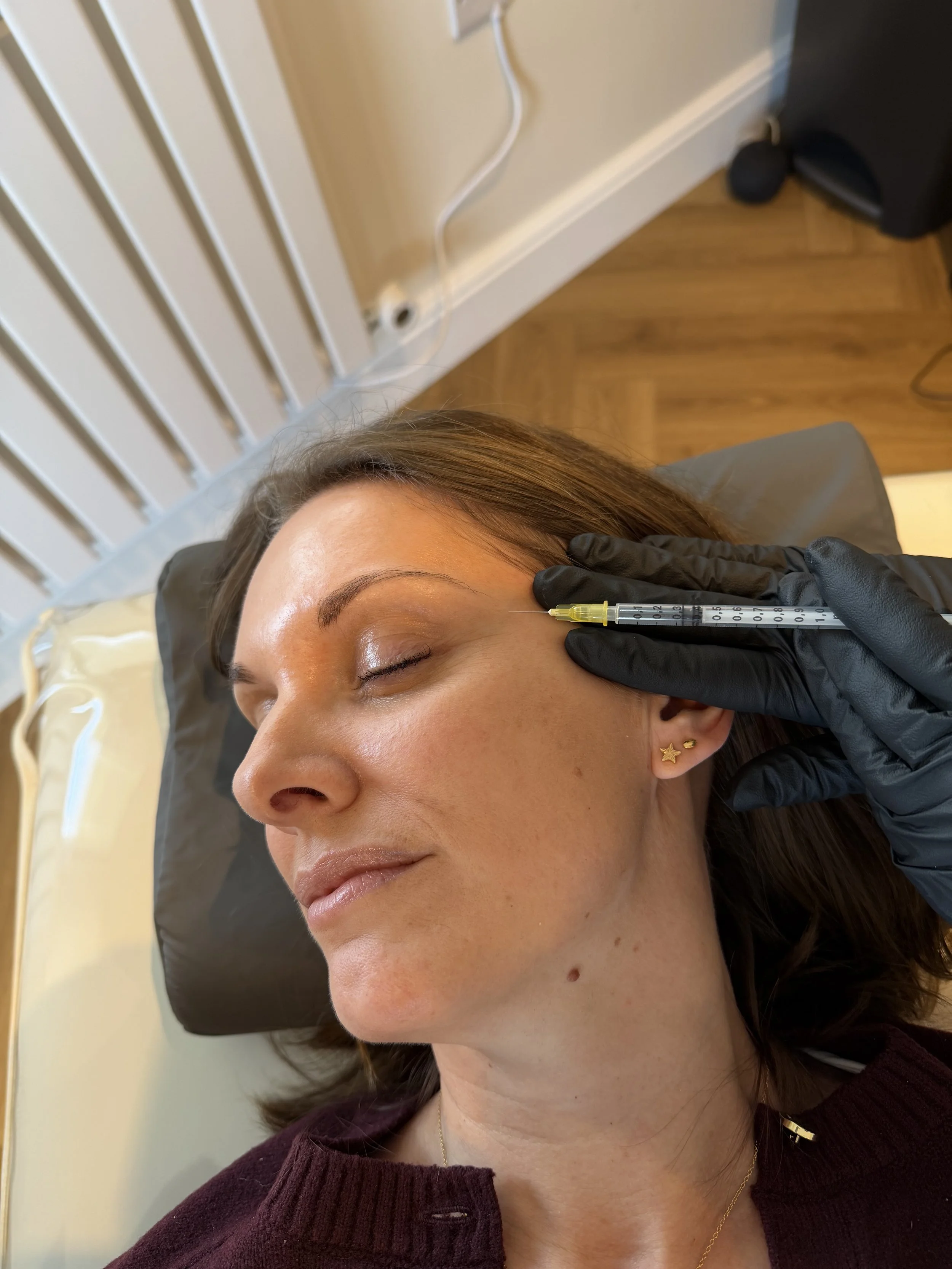 A woman with brown hair and earrings is receiving an injection near her temple while lying on her side, with a healthcare professional wearing black gloves administering the injection.
