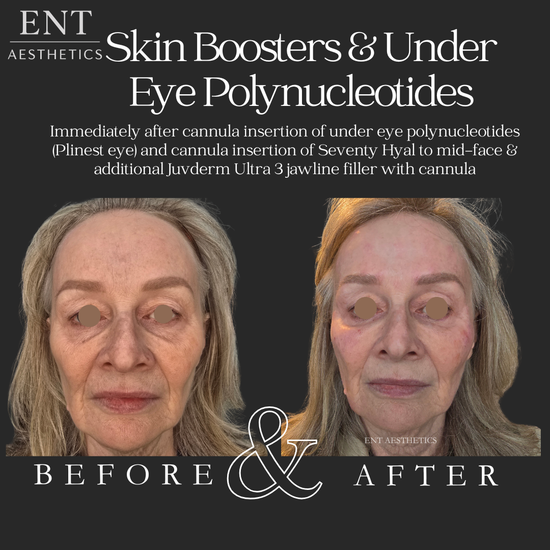 Skin & polys 21.5.26.png
