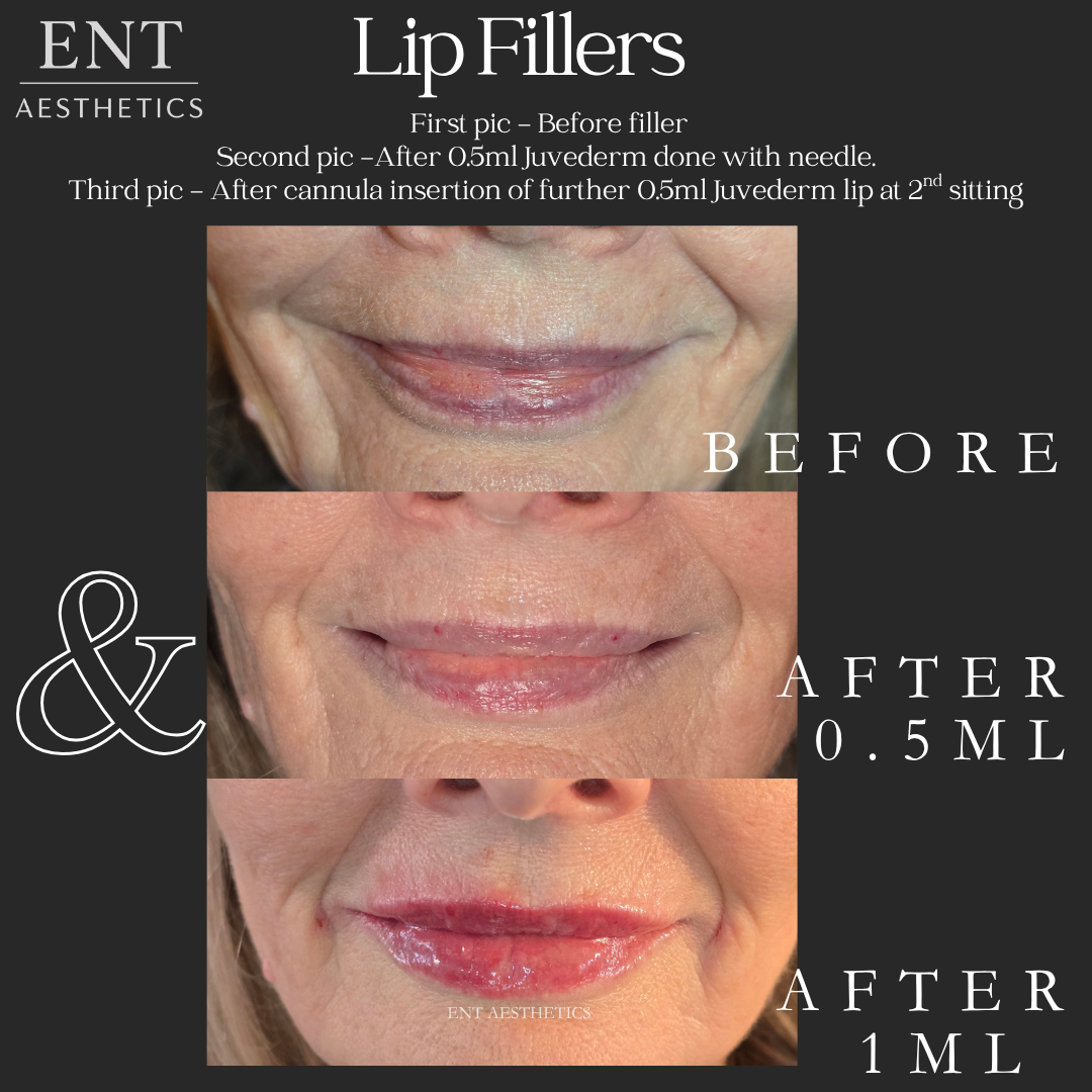 Mum Lips 21.5.26-2.png