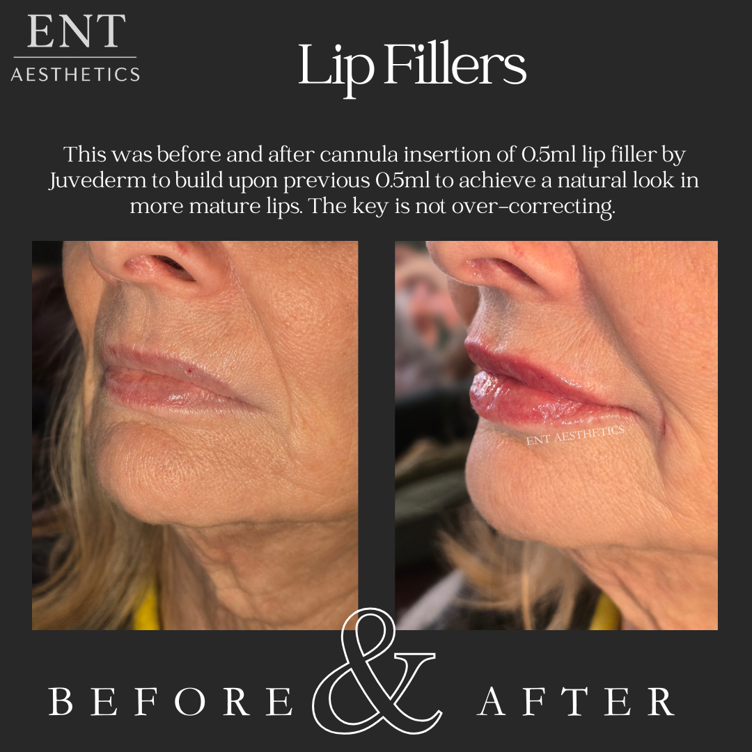 Mum Lips 21.5.26.png