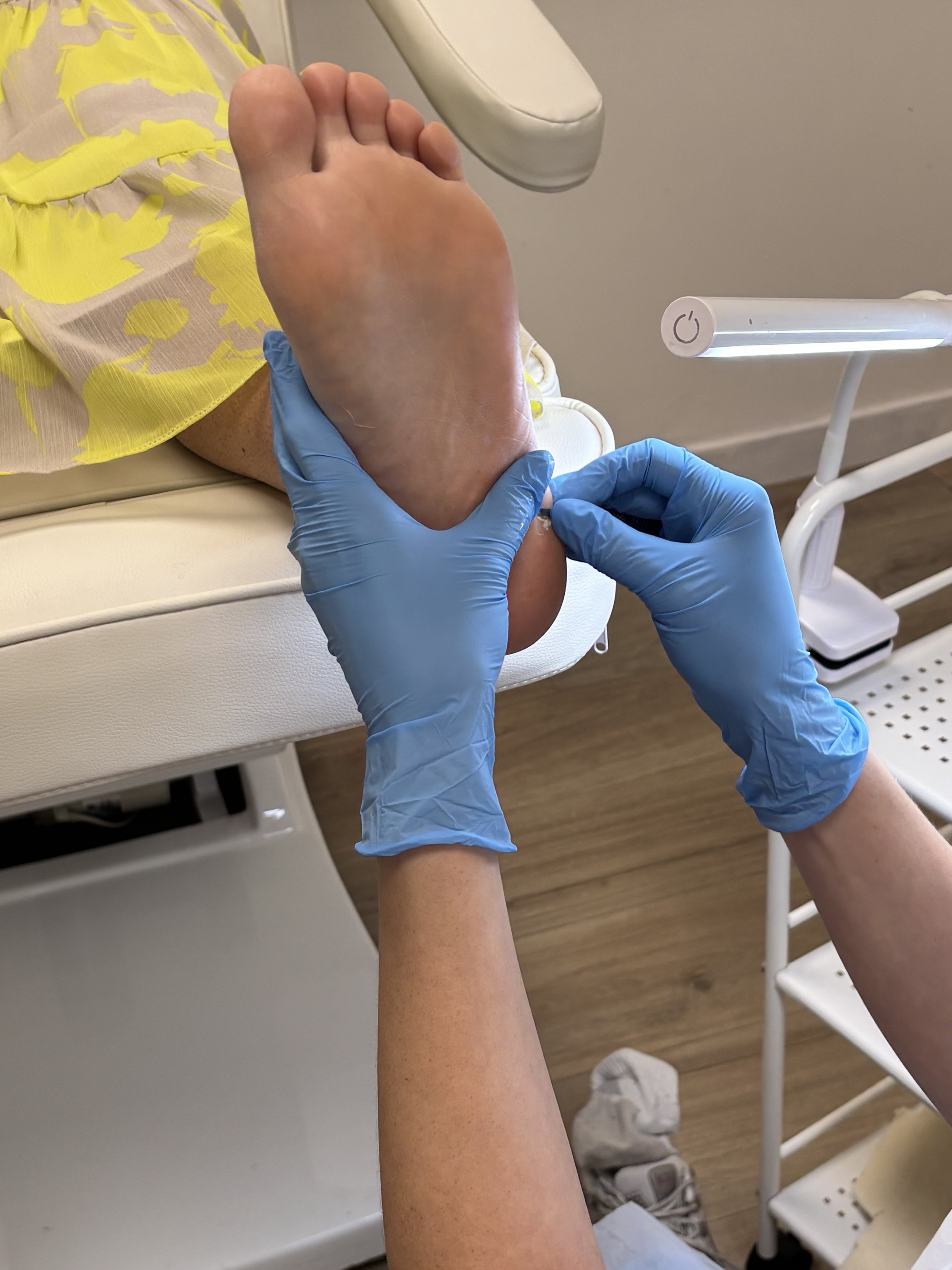 A person's foot being examined or treated by a healthcare professional wearing blue gloves in a medical setting.
