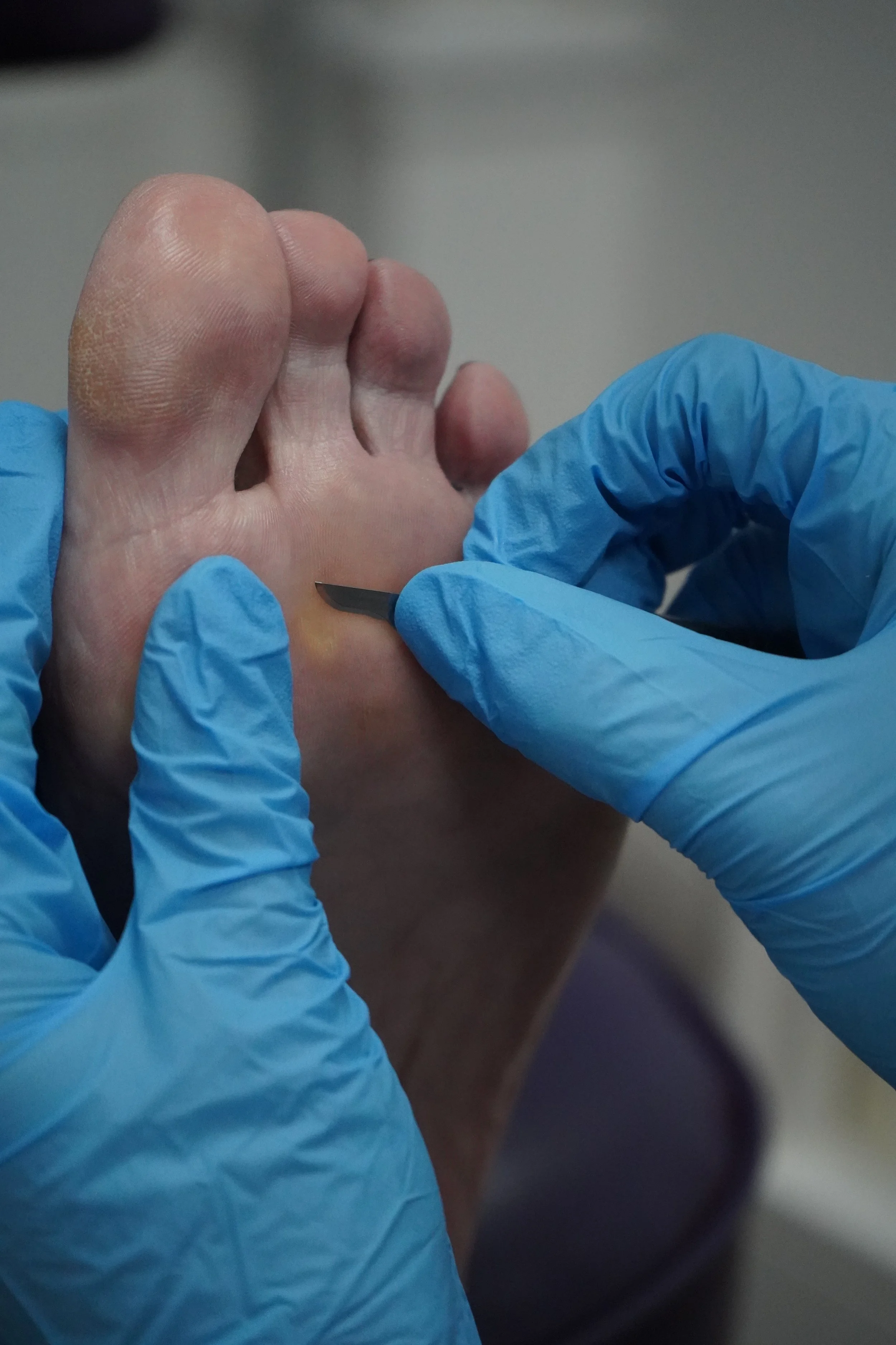 Standard Podiatry Treatment