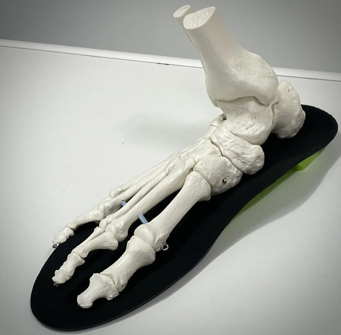An anatomical model of a human foot's skeletal structure, showing bones on a black base.
