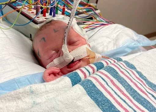 Newborn baby in hospital bed connected to wires and tubes for medical care.