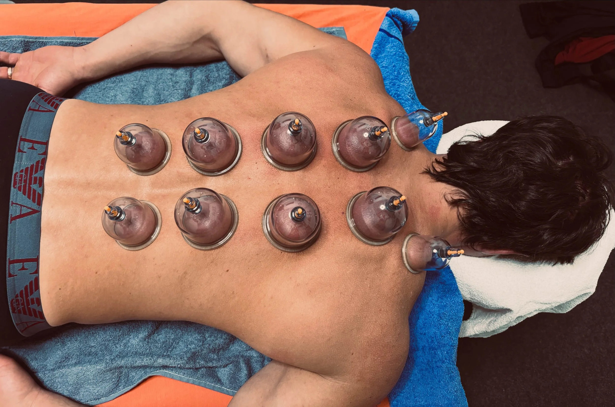 Beim Schröpfen kommen Schröpfgläser  zum Einsatz, die gezielt auf Bereiche mit wahrgenommenen Muskelverhärtungen (Myogelosen) gesetzt werden.