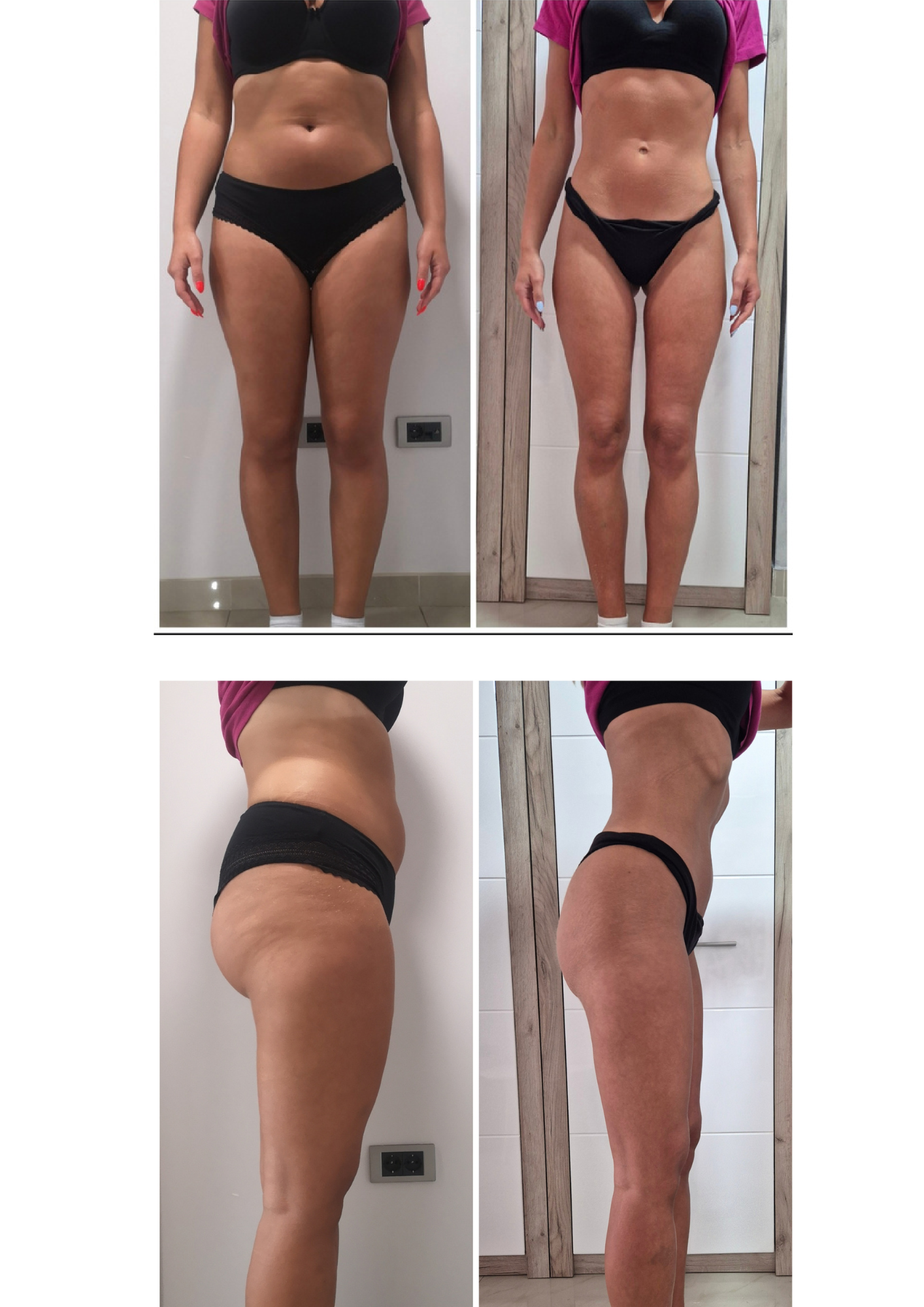 Rezultati nakon samo 5 nedelja posle TURBO paketa u BODY SENSE studiu.