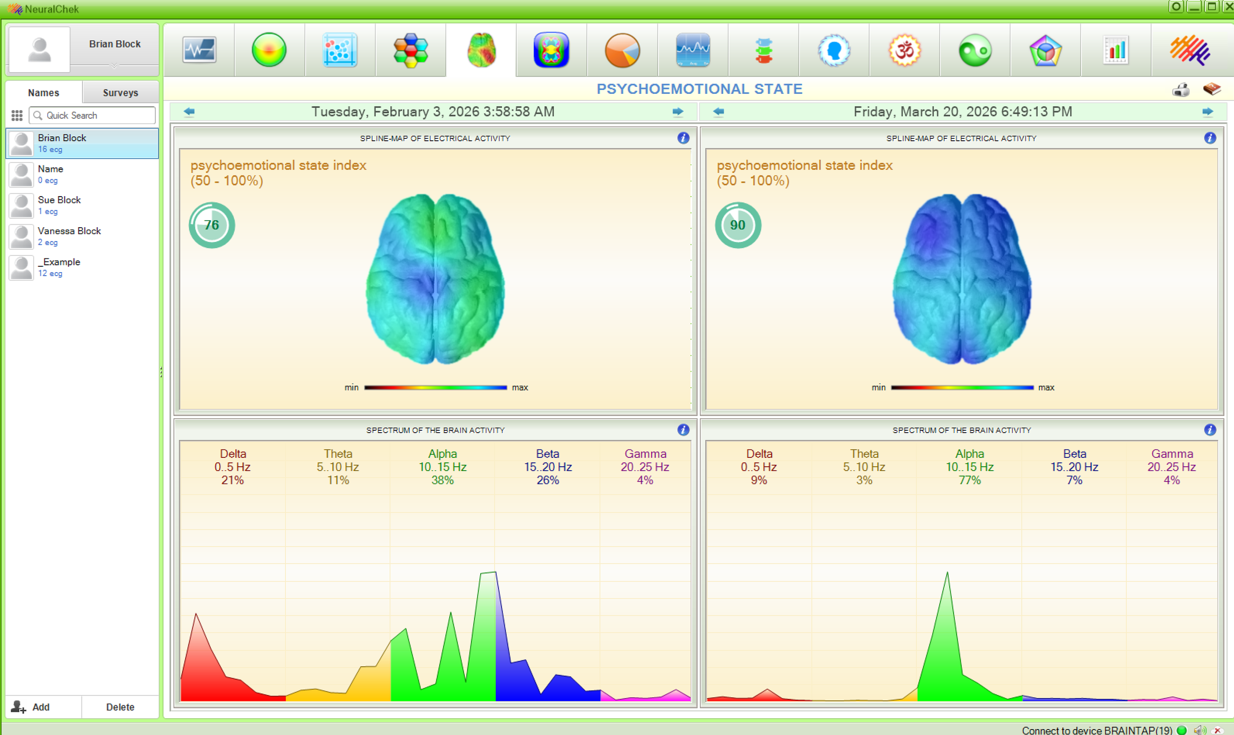 Screenshot of a brain monitoring software showing electrical activity and psychoemotional state indexes of a person named Brian Block at different times, with colorful brain maps and spectra graphs.