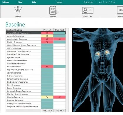 Medical report and X-ray image displaying a skeletal view of the lower spine and pelvis with color-coded baseline readings of various body systems.