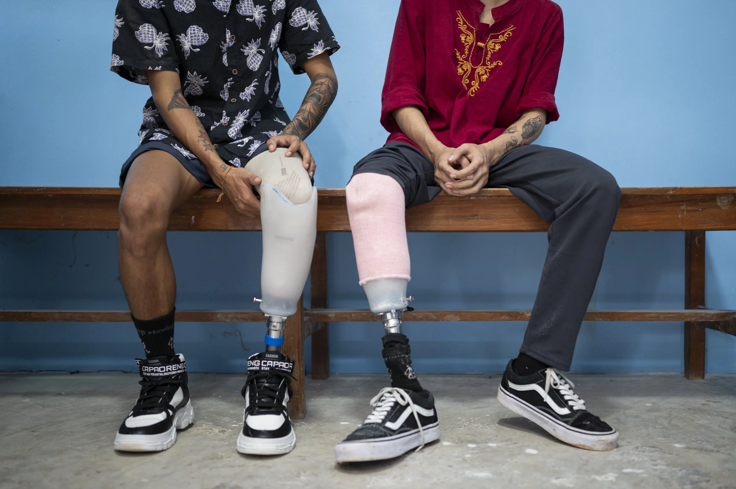 Free 3D-printed prostheses put hope in arm’s reach for war amputees - DVB & Mizzima