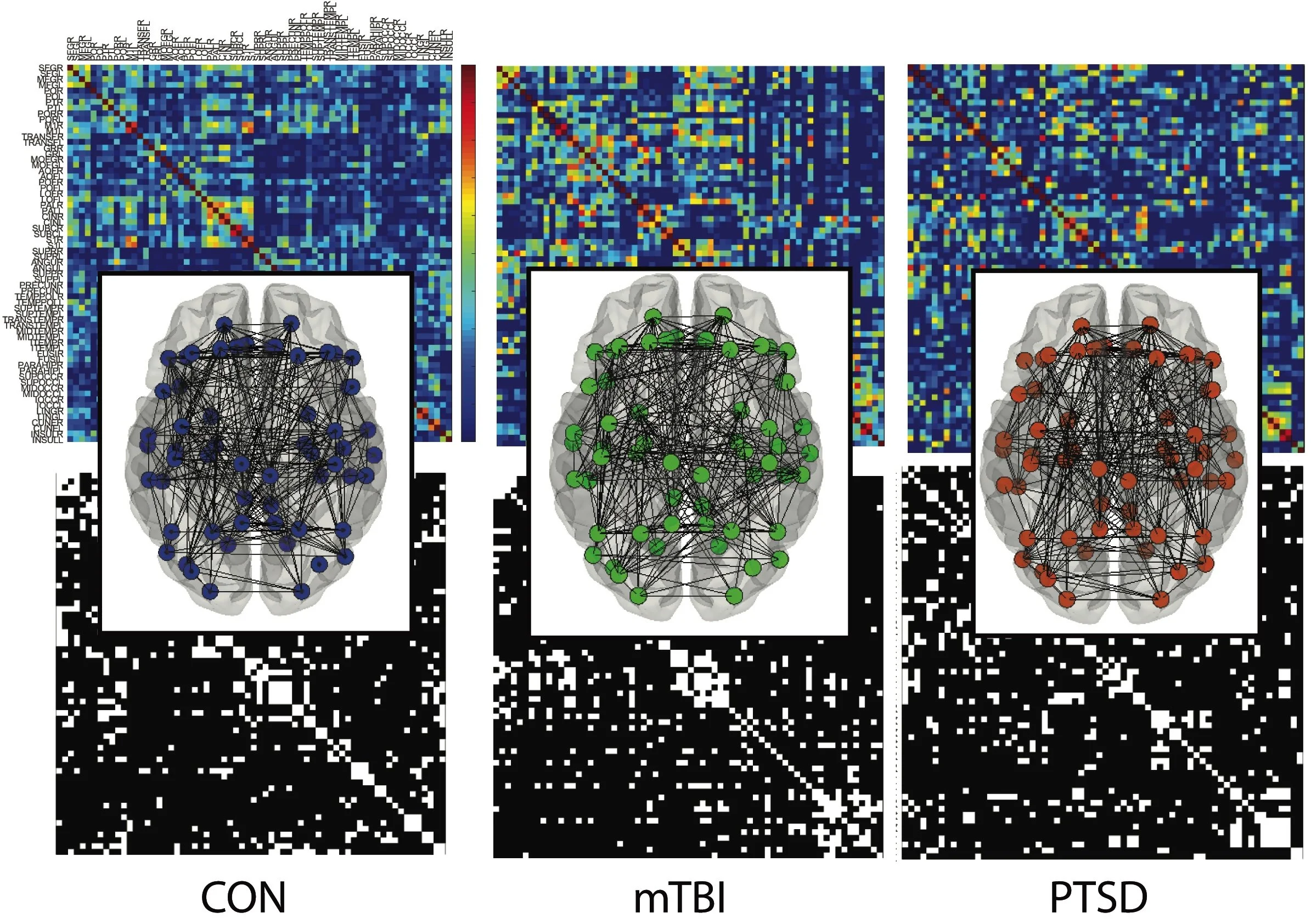 Diagram comparing brain connectivity patterns in control, mTBI, and PTSD groups, showing brain network graphs overlaid on brain images with associated heatmaps and data matrices.