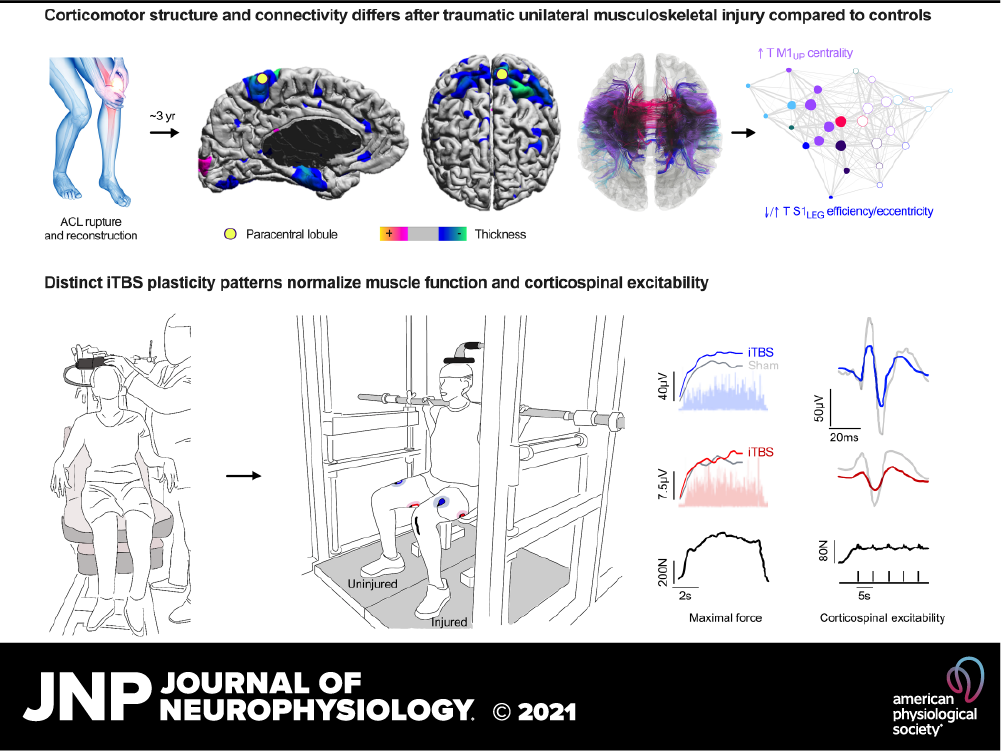 Scientific infographic showing brain structure, connectivity, and plasticity patterns related to musculoskeletal injury and corticospinal excitability, with illustrations of patient assessments and graphs of neural data.