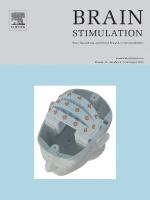 Cover of a book titled 'Brain Stimulation' with an illustration of a medical device on the front.