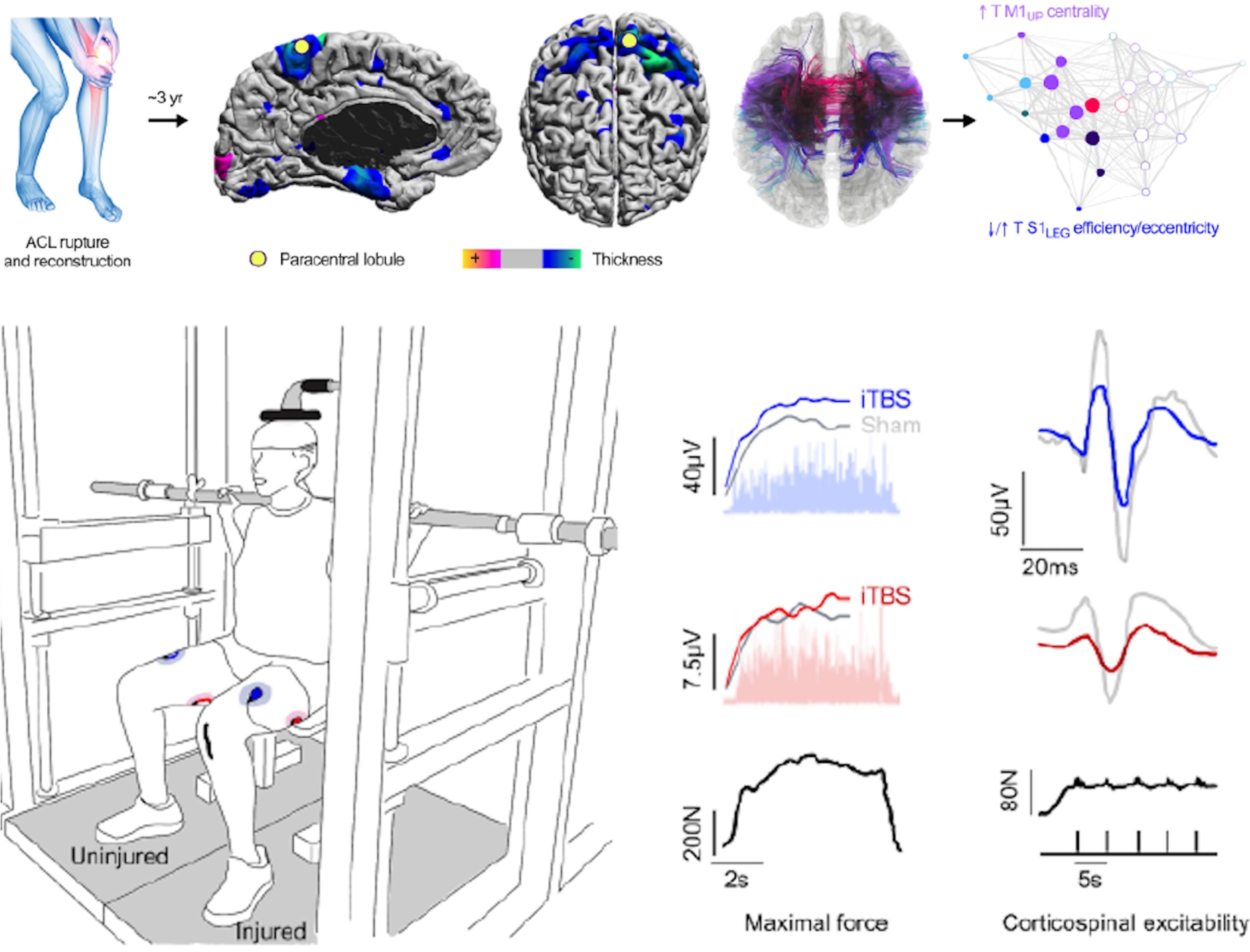 Changes in brain structure and function after traumatic musculoskeletal injury