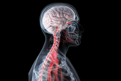 Medical illustration of a human head and neck showing the brain and spinal cord in red within a semi-transparent skull and neck outline.