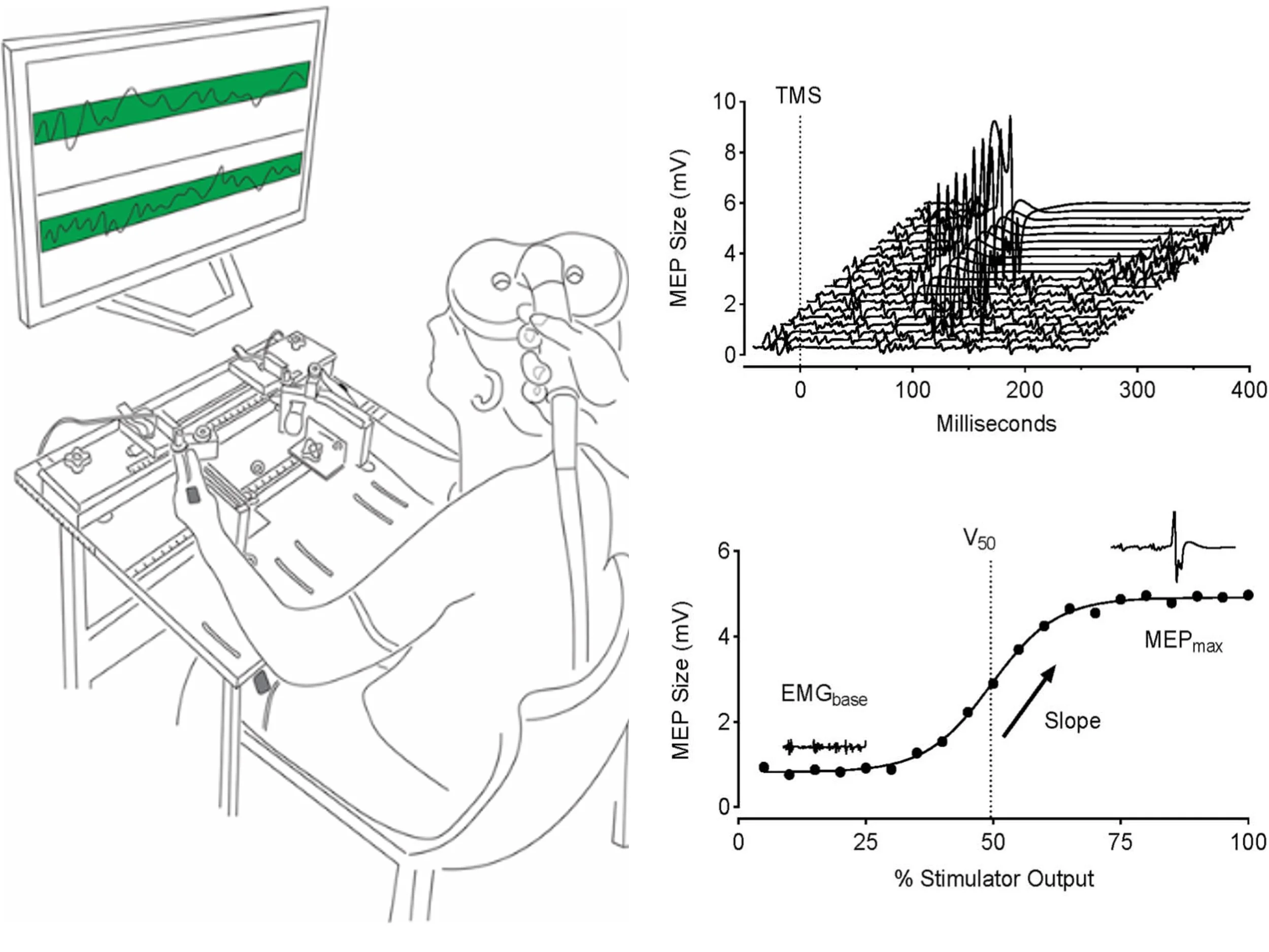 We evaluated the agreement and consistency of absolute- and relative-intensity TMS stimulus–response curves across upper-limb, lower-limb, and axial muscles.