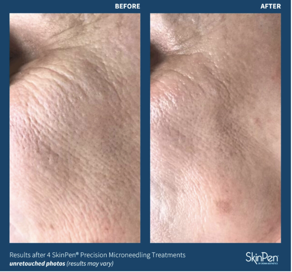 Best Medspa in Sunnyside, NY, 11104