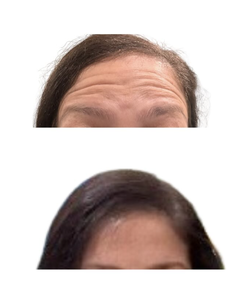 Best Medspa in Sunnyside, NY, 11104