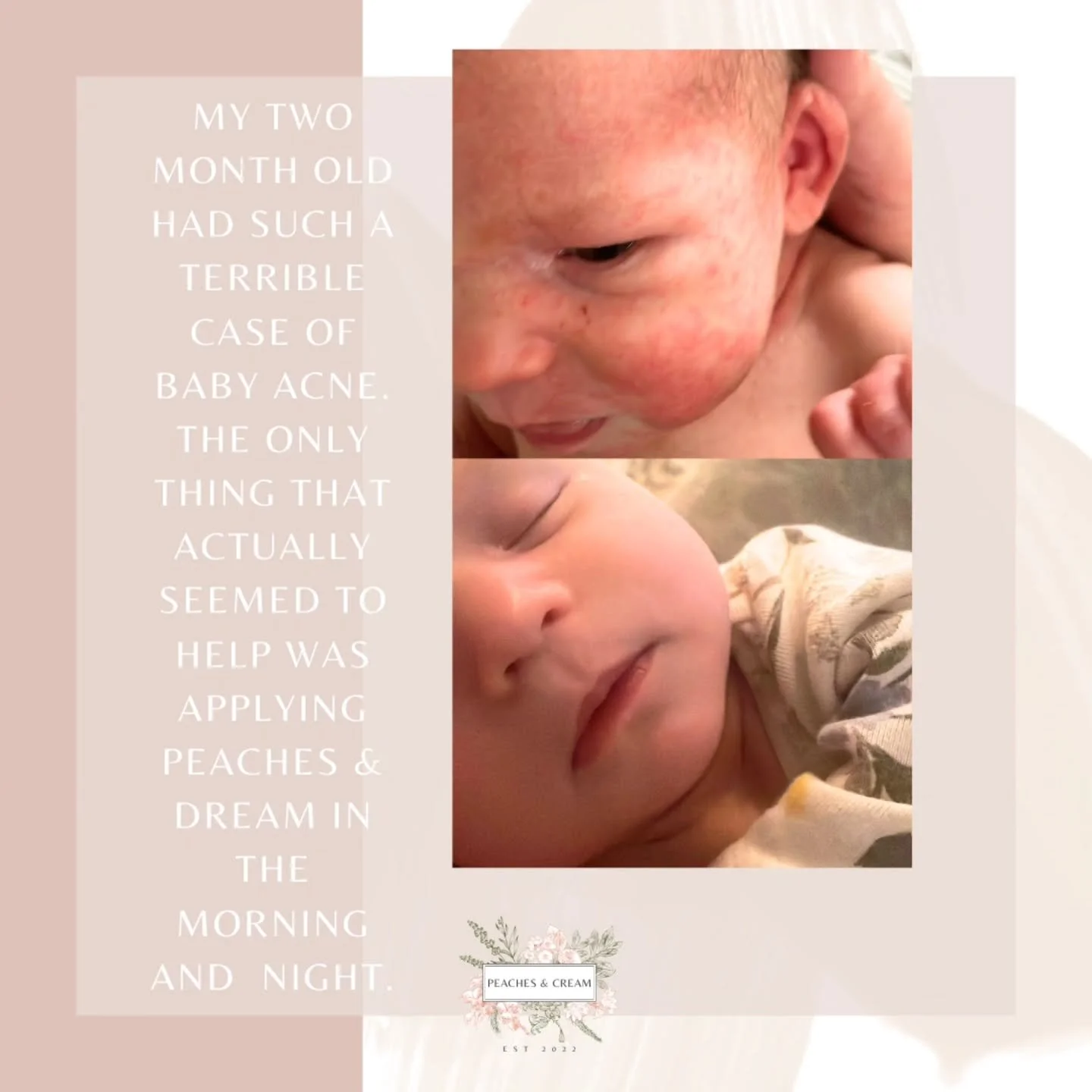 Sweet baby R had a rash all over her body for weeks. After one week of regular use of Peaches &amp; Dream her perfect skin was able to heal. Your success stories are why I love making these tallows!