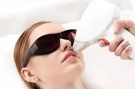 Upper Lip Laser Women