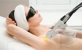 Full Body Laser Women