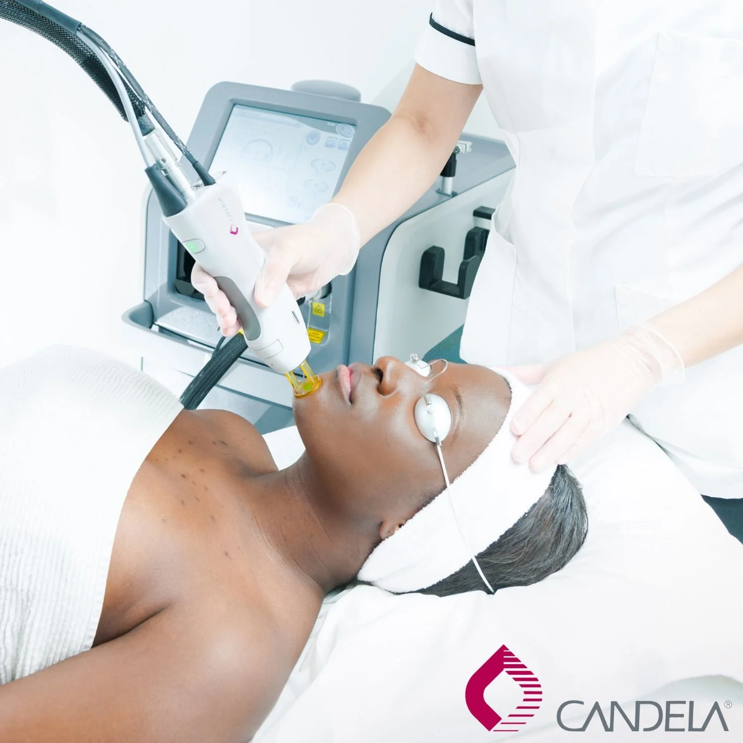 Face Laser Women