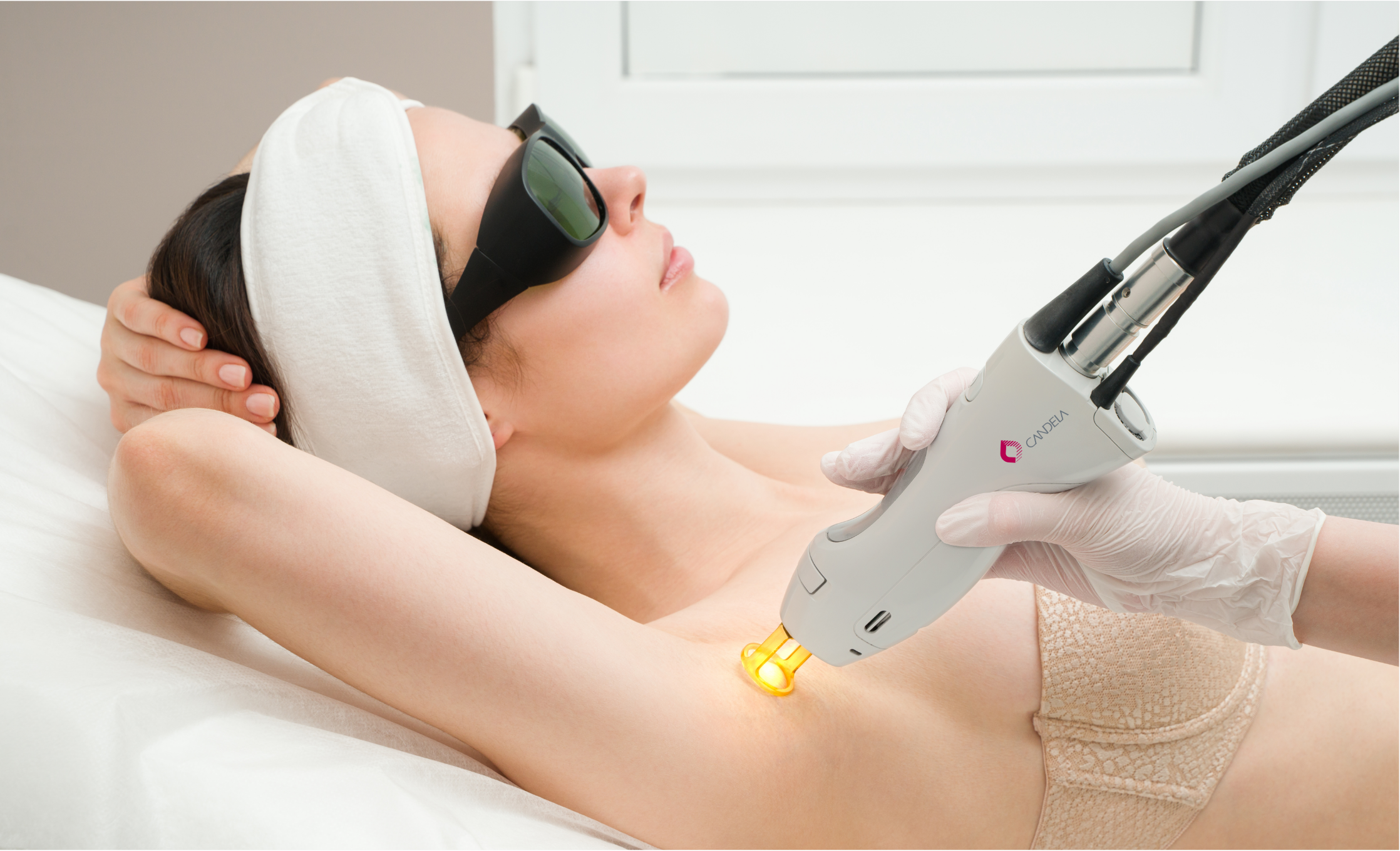 Underarms Laser Women