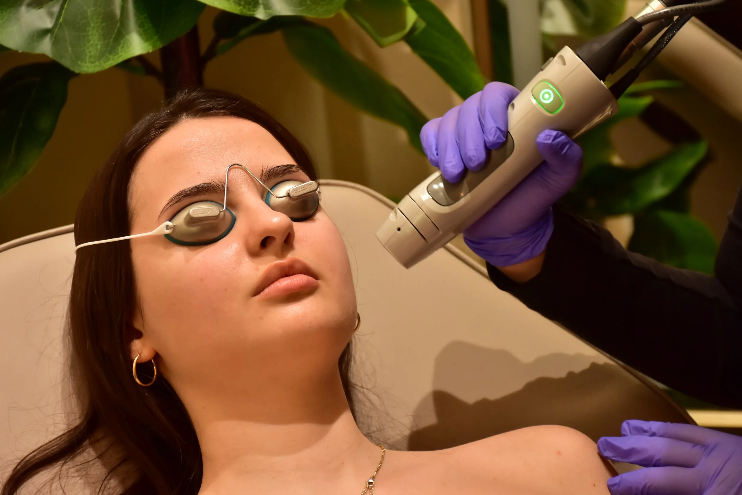 Sideburns Laser Women