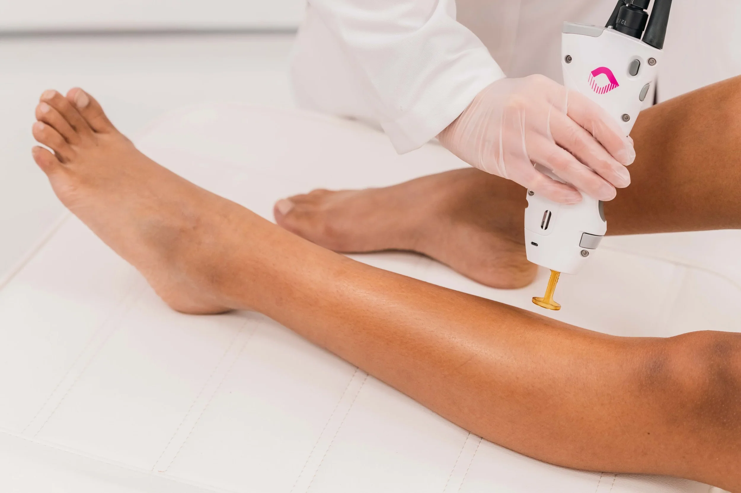 Lower Legs Laser Women