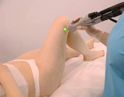 Full Legs Laser Women