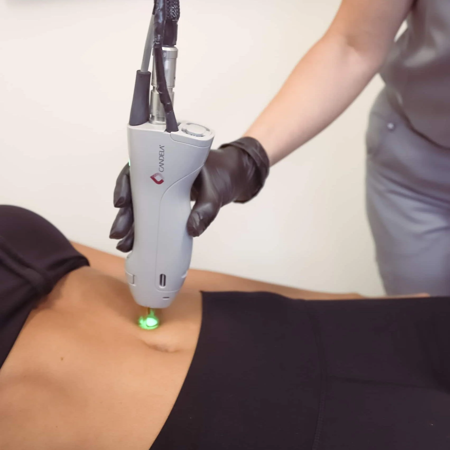 Belly Laser Women