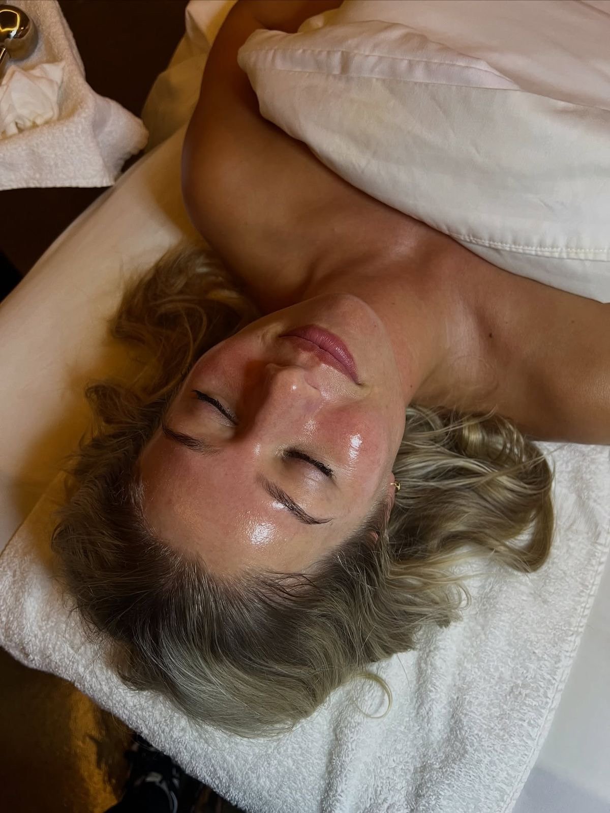 Why Your Acne Isn’t Improving (Even Though You’re “Doing Everything Right”)