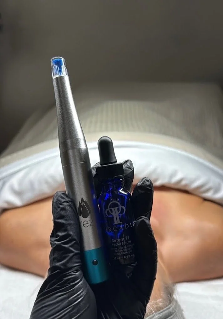 A person's hand in a black glove holding a silver nanoneedling pen,  a small blue bottle of serum in front of their abdomen, with their legs and a white pillow visible in the background.