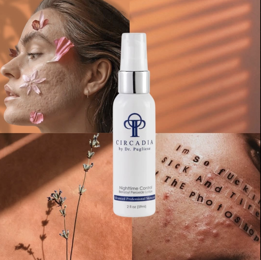 A skincare product called Circadia by Dr. Pugliese, Nighttime Control Benzoyl Peroxide Lotion, is centered in the image. Behind the product, there are four quadrants: top left shows a woman with skin imperfections and flower petals on her face; top right features blurred orange light patterns; bottom left displays a sprig of lavender against a warm background; bottom right reveals a close-up of skin with acne scars and the text 'I'm so lucky I suck and I like the photoshopped' written on it.