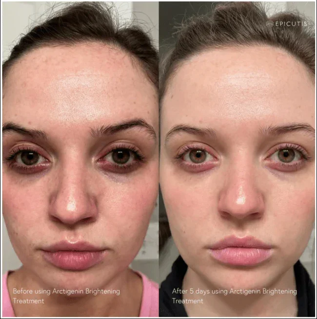 epicutis-arctigenin-brightening-treatment-3171379.webp