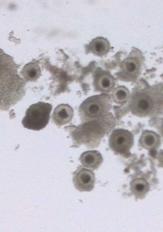 Equine Oocyte Aspiration Side