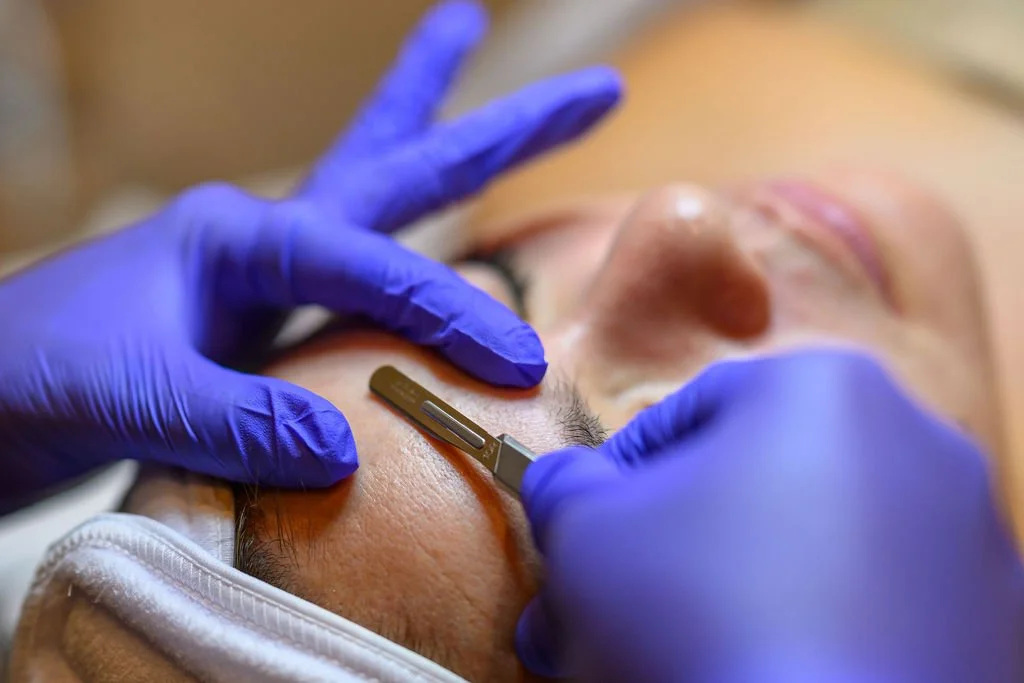 What Is Dermaplaning and How Will It Benefit Your Skin?