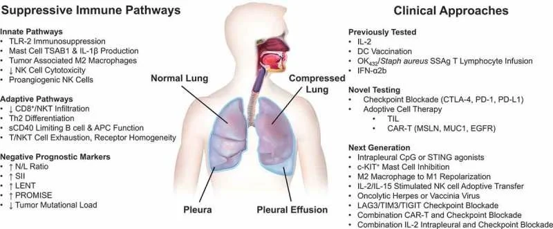 Making cold malignant pleural effusions hot: driving novel immunotherapies