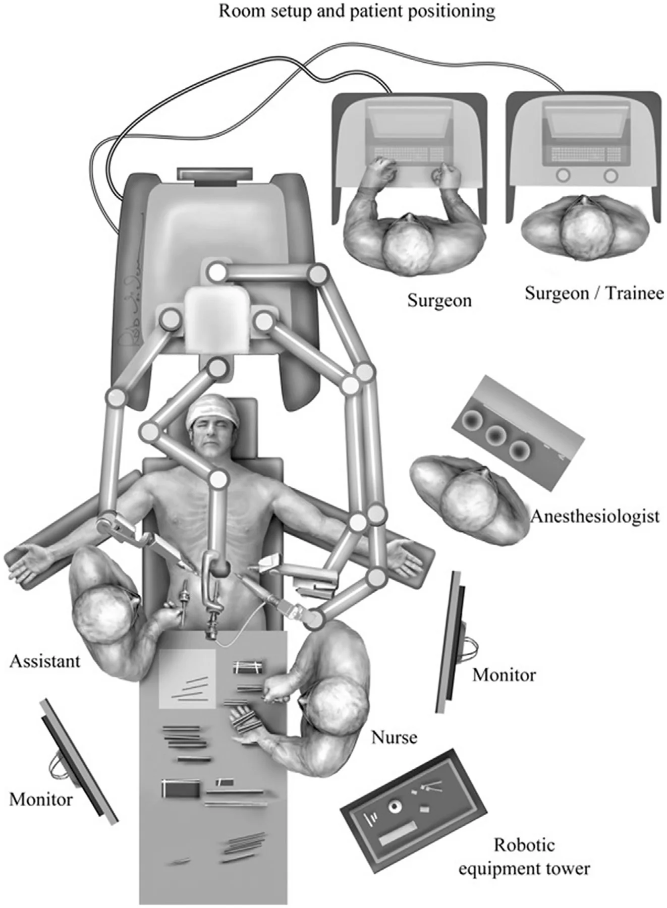 Surgical Techniques for Robotically-Assisted Laparoscopic Paraesophageal Hernia Repair