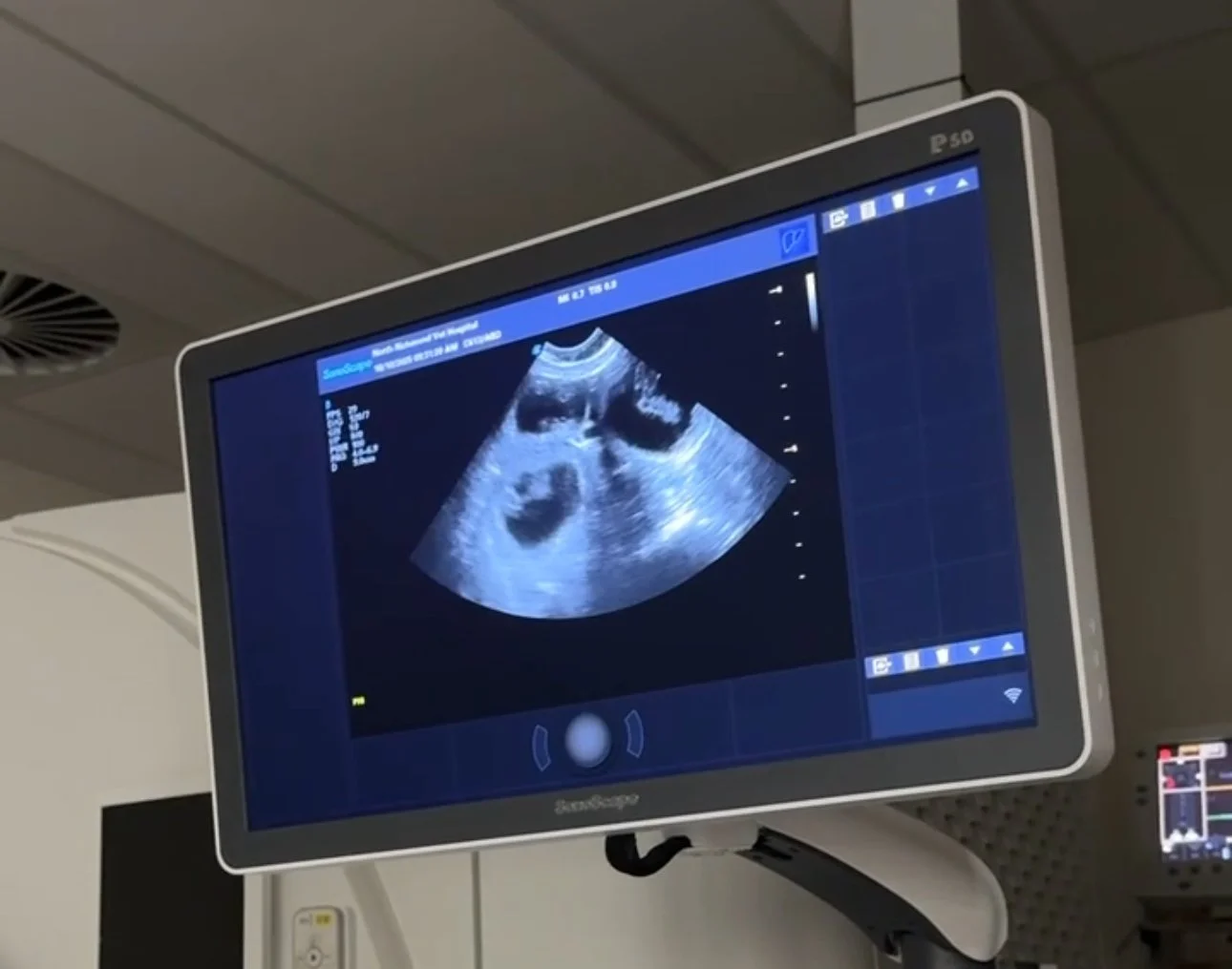 Confirmation of Pregnancy