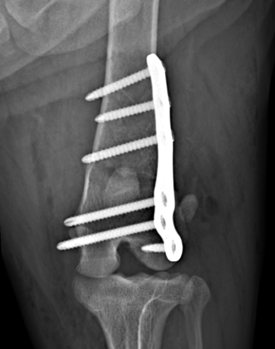Radiografia del femore fratturato di un cane, trattata con una placca in titanio e acciaio con un'ottima riduzione e un ottimo risultato postoperatorio