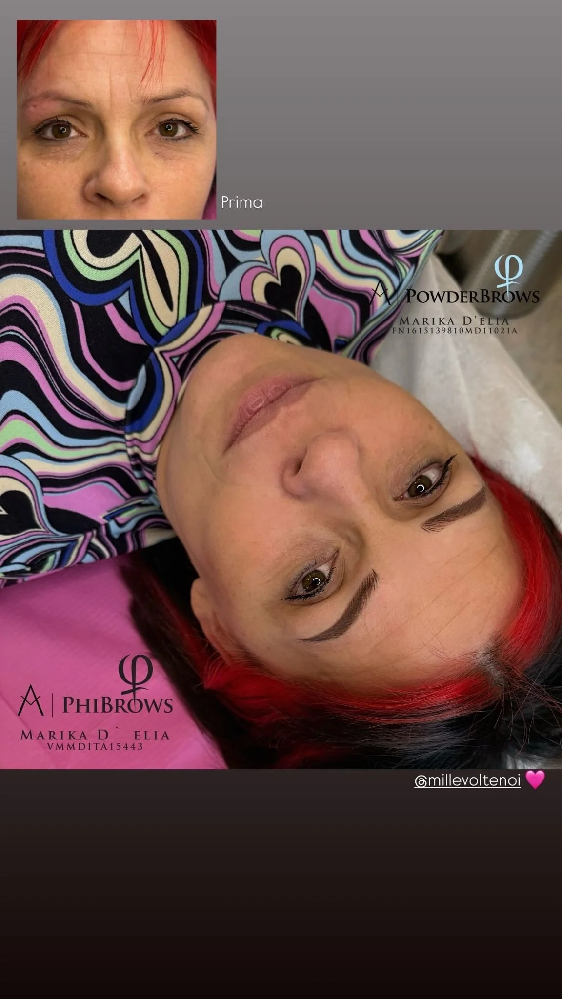 Immagine di una donna con capelli rossi e sopracciglia tatuate, mostrata prima di un trattamento estetico. La donna è sdraiata, indossa un vestito con un disegno colorato e ha un leggero trucco sul viso.