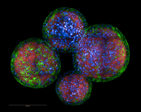 Microscopic view of four spherical cells with vibrant colors, including red, blue, and green, on a black background.