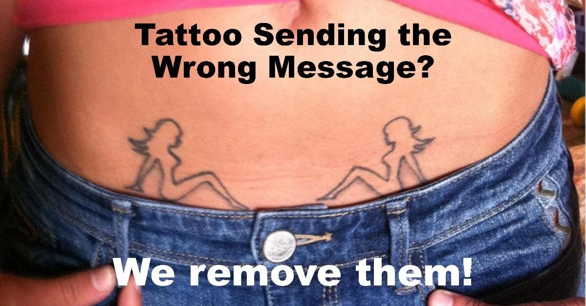 Regretting Your Tattoo Decision Last Year?