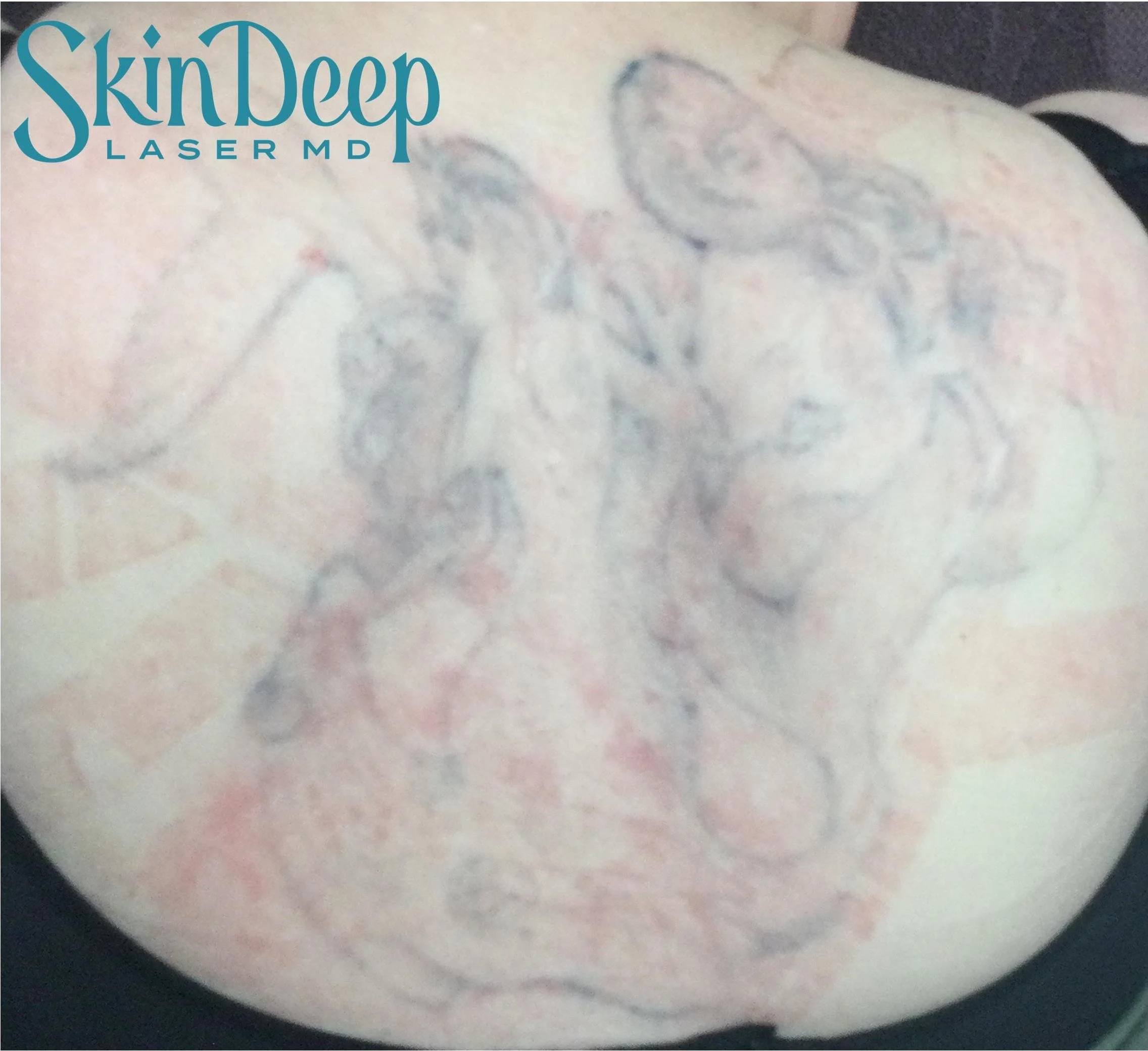 Pt 001 Tattoo Post 6 Tx.jpg