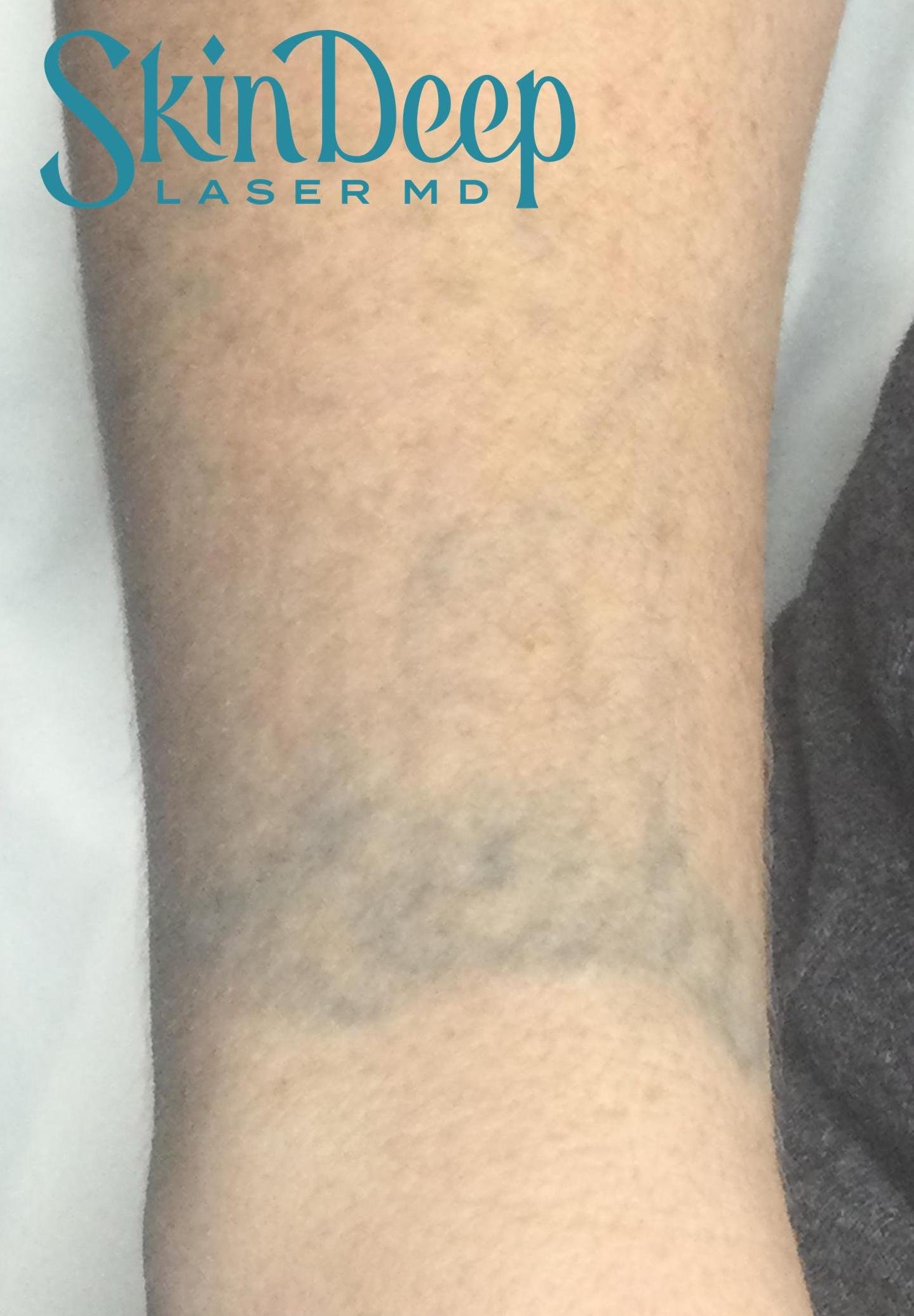 Pt 002 Tattoo2 Post 5 Tx.jpg