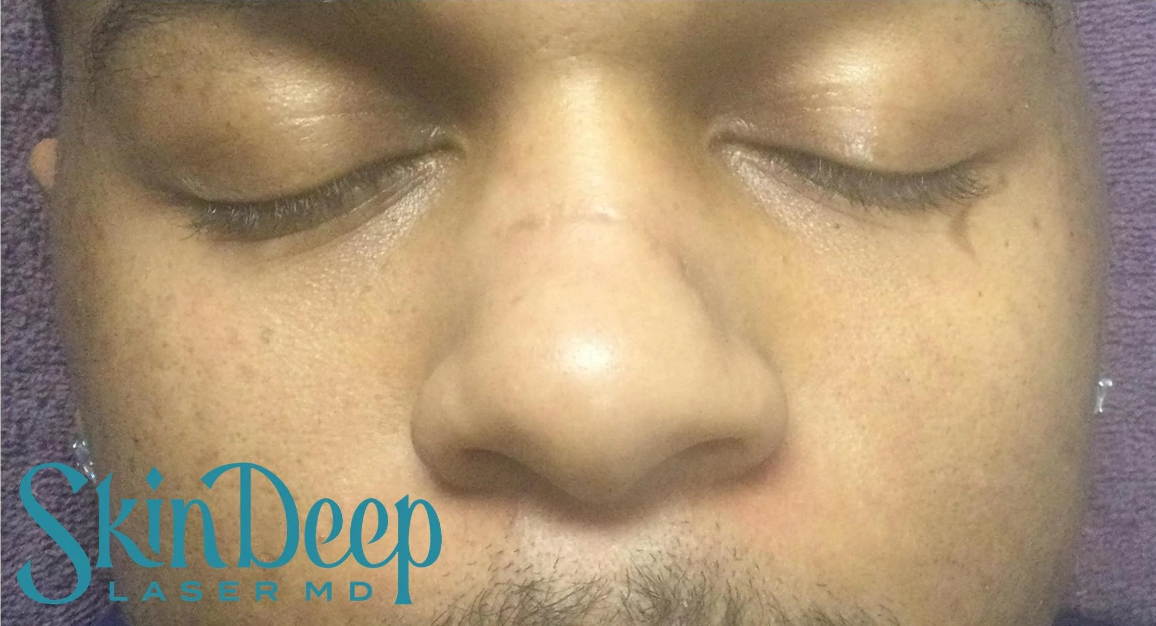 Pt 007 Scar Post 2 Tx.jpg