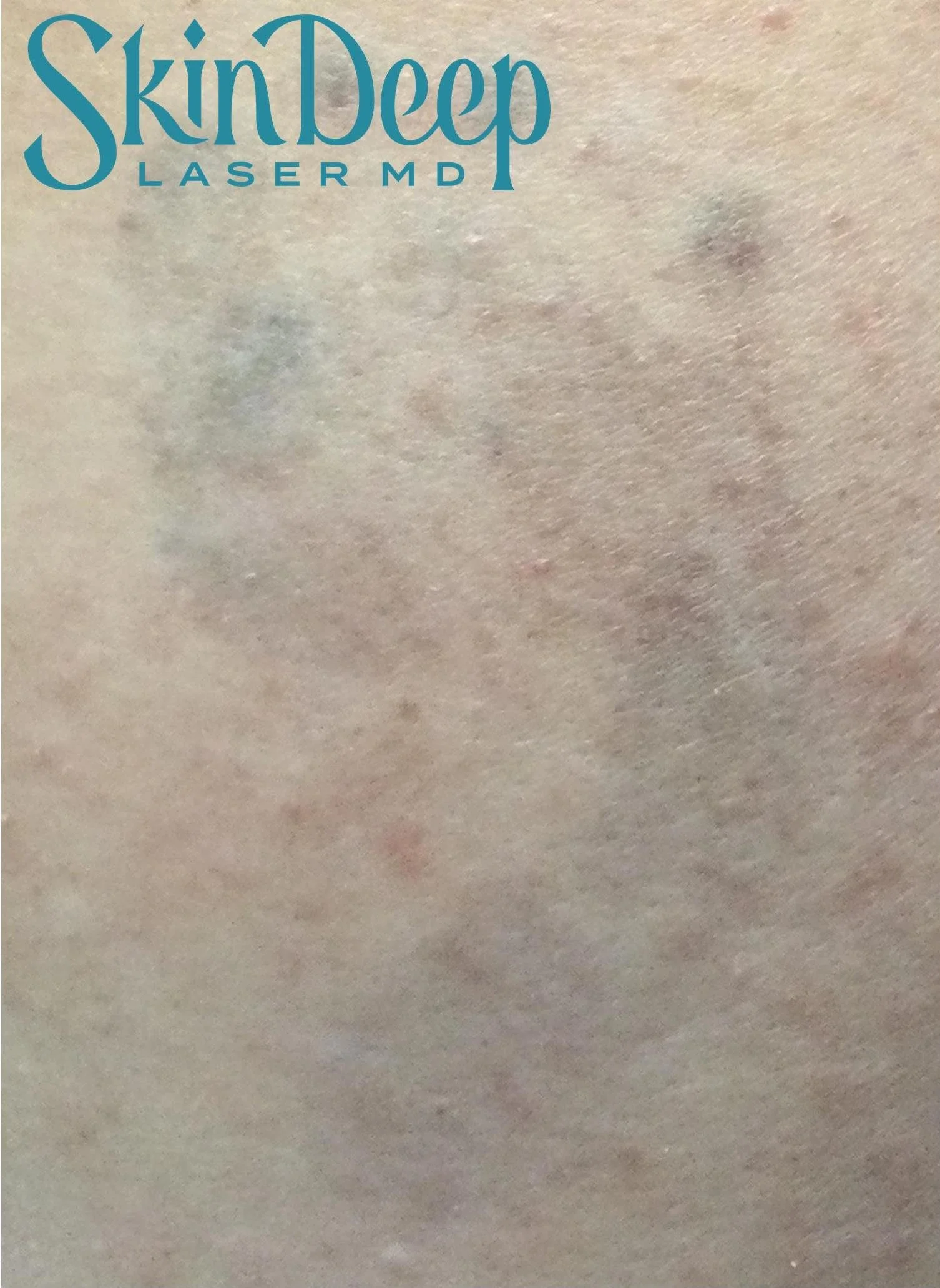 Pt 015 Tattoo Post 3 Tx.jpg