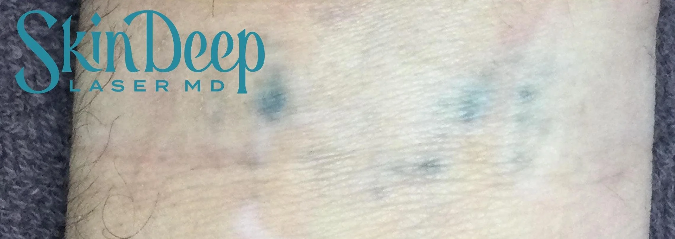 Pt 016 Tattoo Post 3 Tx.jpg